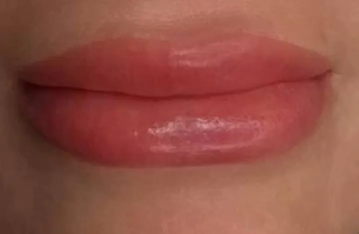 Después: Micropigmentación de labios.